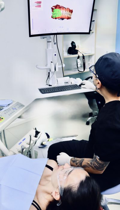 carillas dentales urgente